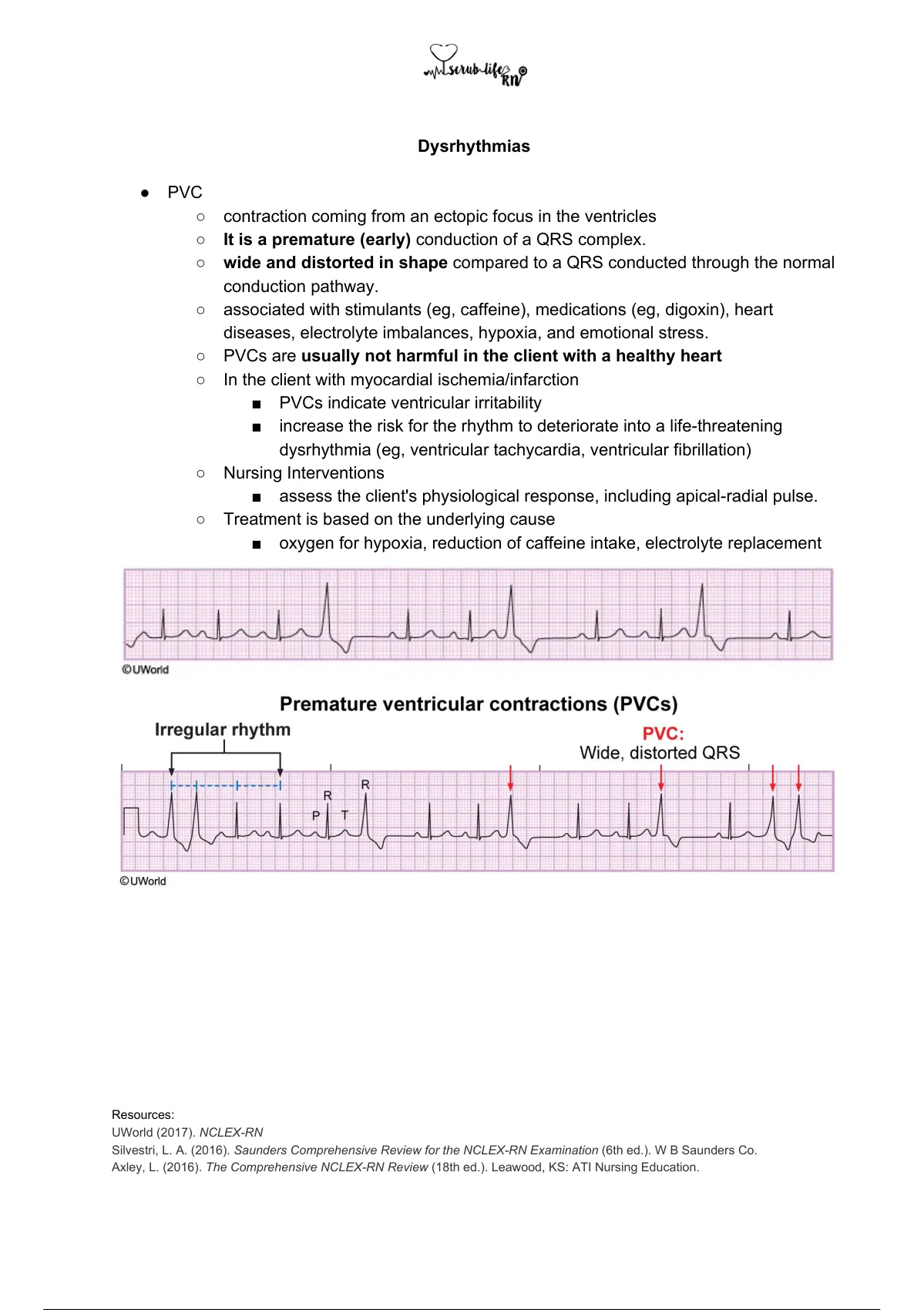 EKG Readings For Dysrhythmias W/ Pictures Of Strips - NCLEX RN - Stuvia US