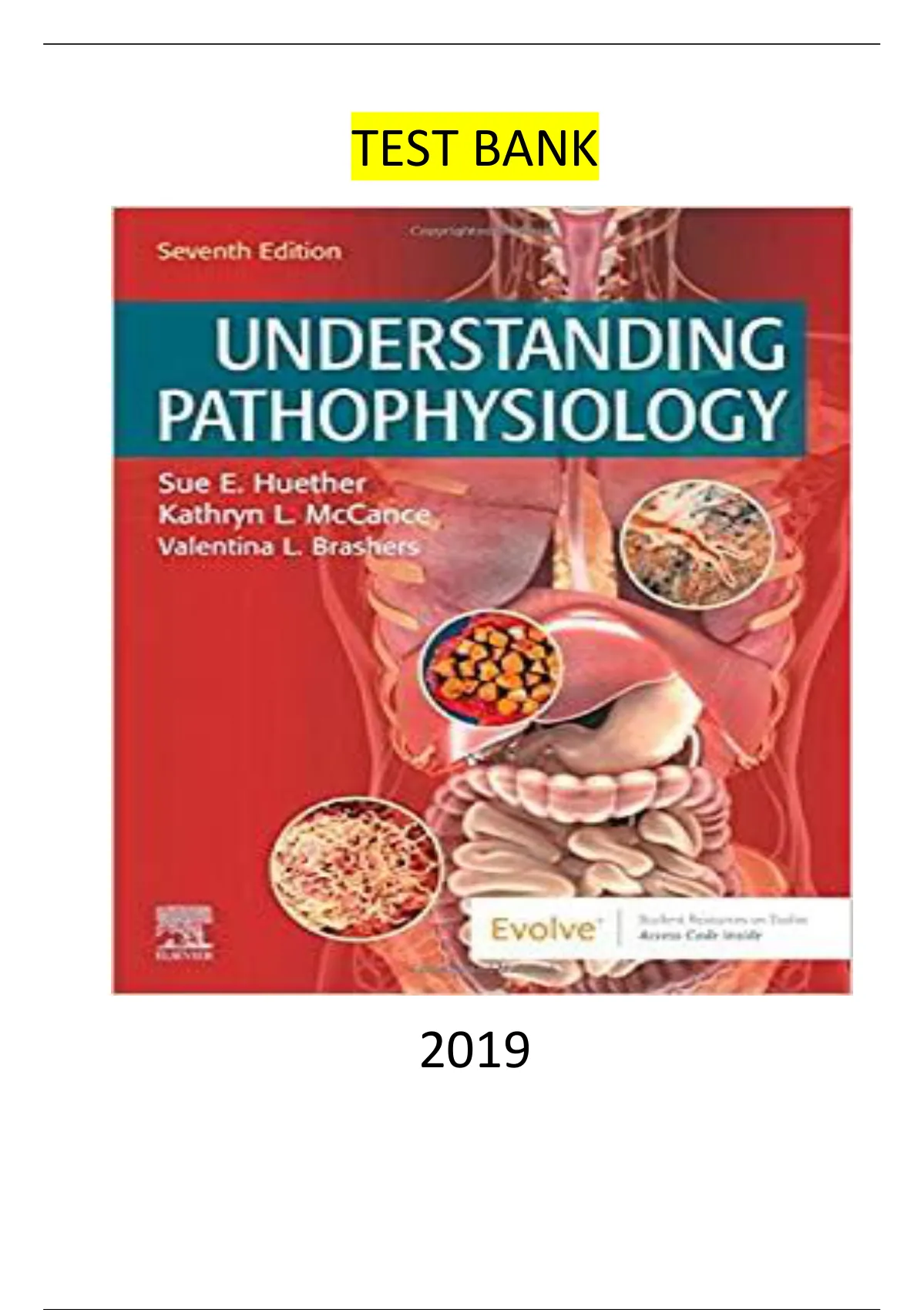 Understanding Pathophysiology - E-Book 7th Edition By Sue E. Huether ...