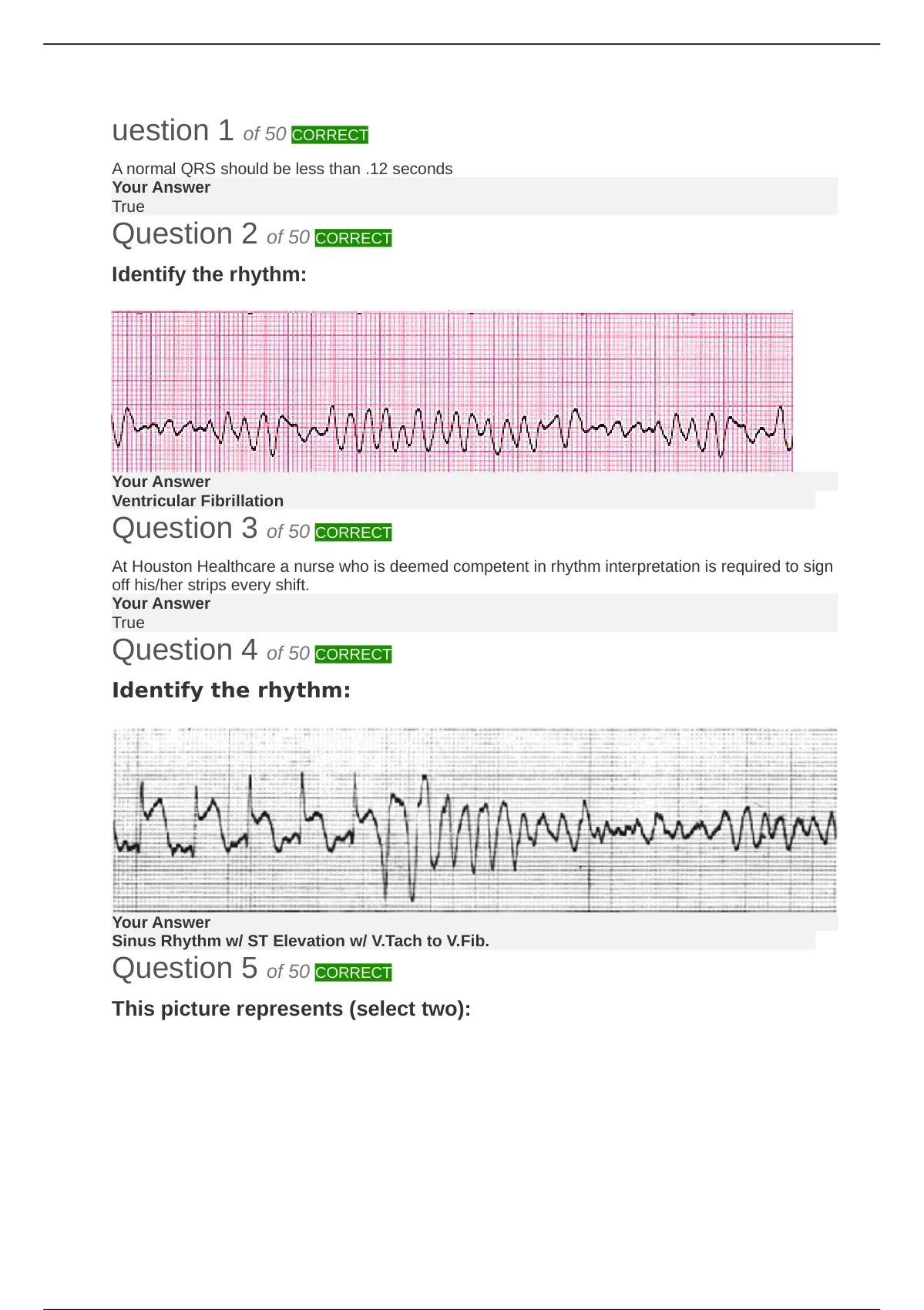 Relias Dysrhythmia Basic Test Answers Solution guide 2022 ( updated