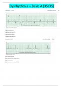 Relias Dysrhythmia Basic  A Test Answers 2023 ( A+ GRADED 100% VERIFIED)