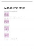 Exam (elaborations) ACLS Rhythm  Identification 