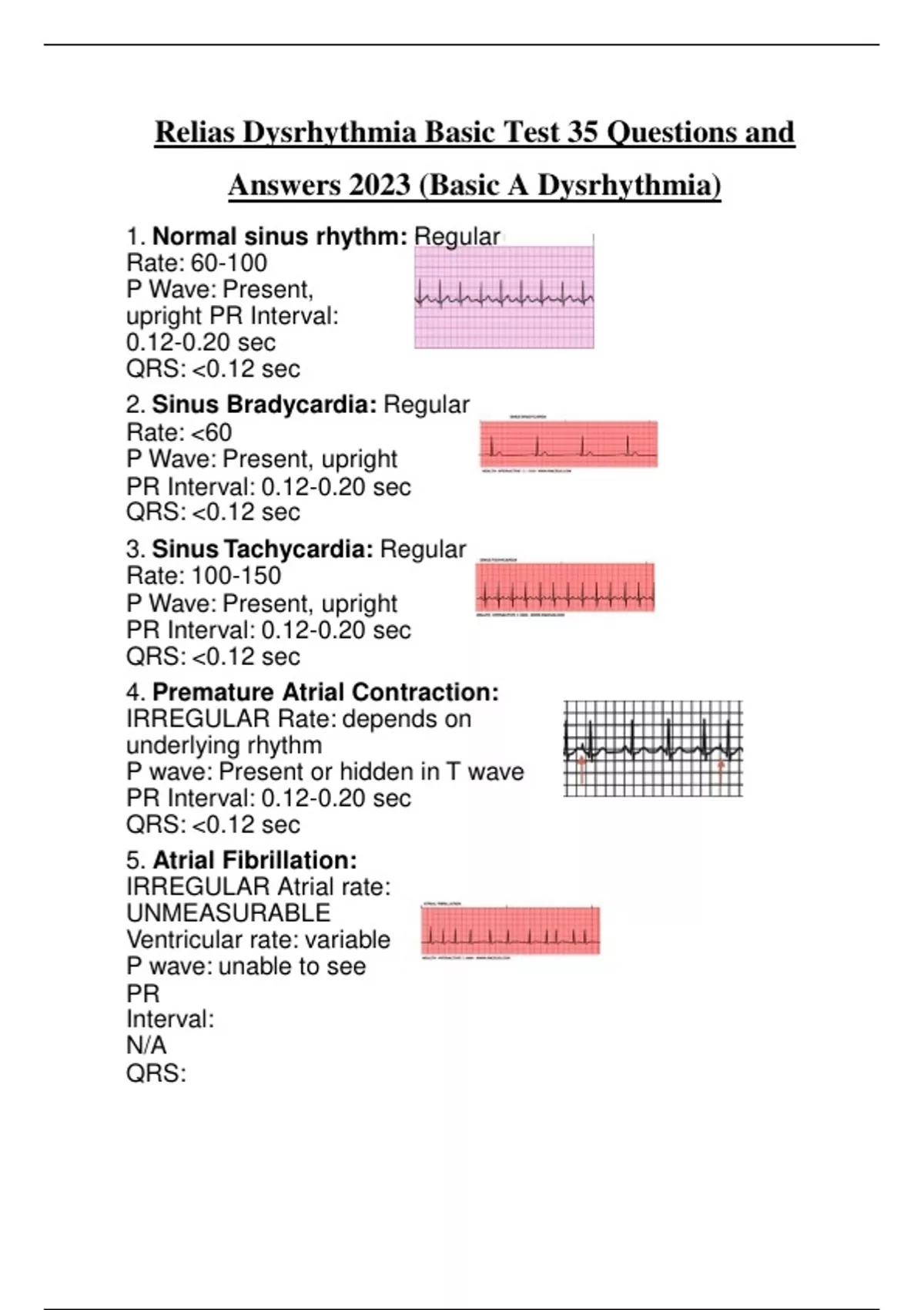 Relias Dysrhythmia Basic Test 35 Questions and Answers 2023 (Basic A