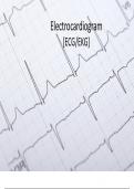 Understanding and introduction to 12 lead ECG/EKG