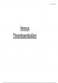 Deep venous thrombosis and pulmonary embolism