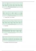 RELIAS BASIC A DYSRHYTHMIA 35 QUESTIONS AND ANSWERS