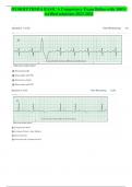 DYSRHYTHMIA BASIC A Competency Exam Relias-with 100%  verified solutions-2023-2024