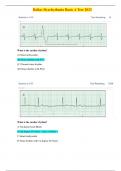 Relias Dysrhythmia Basic A Test 35 Questions and Verified Solutions / A Grade 