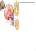 Temporal Bones (Cranium) - Labeling Diagram