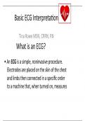 Basic ECG Interpretation WITH QUESTIONS AND ANSWERS.VERIFIED