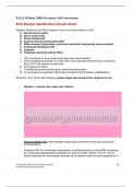 PALS Written 2006 Precourse Self-Assessment ECG Rhythm Identification Answer Sheet