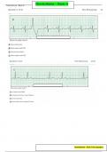 Relias Dysrhythmia Basic A Test   Questions and Answers; (LATEST VERSION   ALREADY PASSED!!)