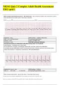NR341 Quiz 2 Complex Adult Health Assessment EKG quiz1.