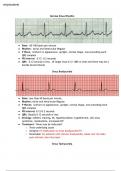 Normal Sinus Rhythm