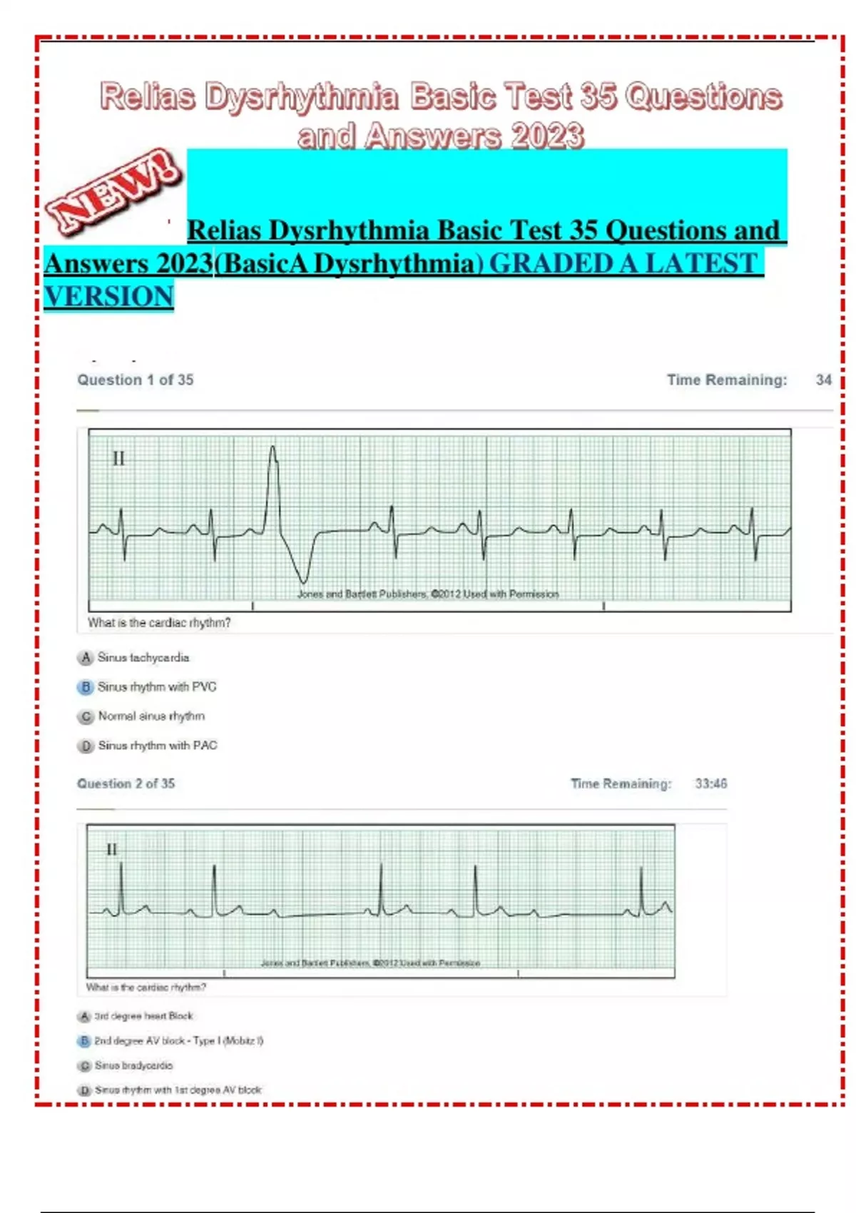 Relias Dysrhythmia Basic Test 35 Questions And Answers 2023 (Basic A ...