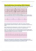 Dysrhythmias (Including EKG Strips)