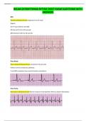 RELIAS DYSRHYTHMIA RYTHM SHEET EXAM QUESTIONS WITH ANSWERS