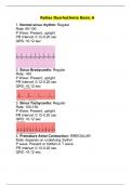 Relias Dysrhythmia Basic A Version 2 (55 Q&A with Rational and rhythm strips): 2023-24 (Best exam preparation document)