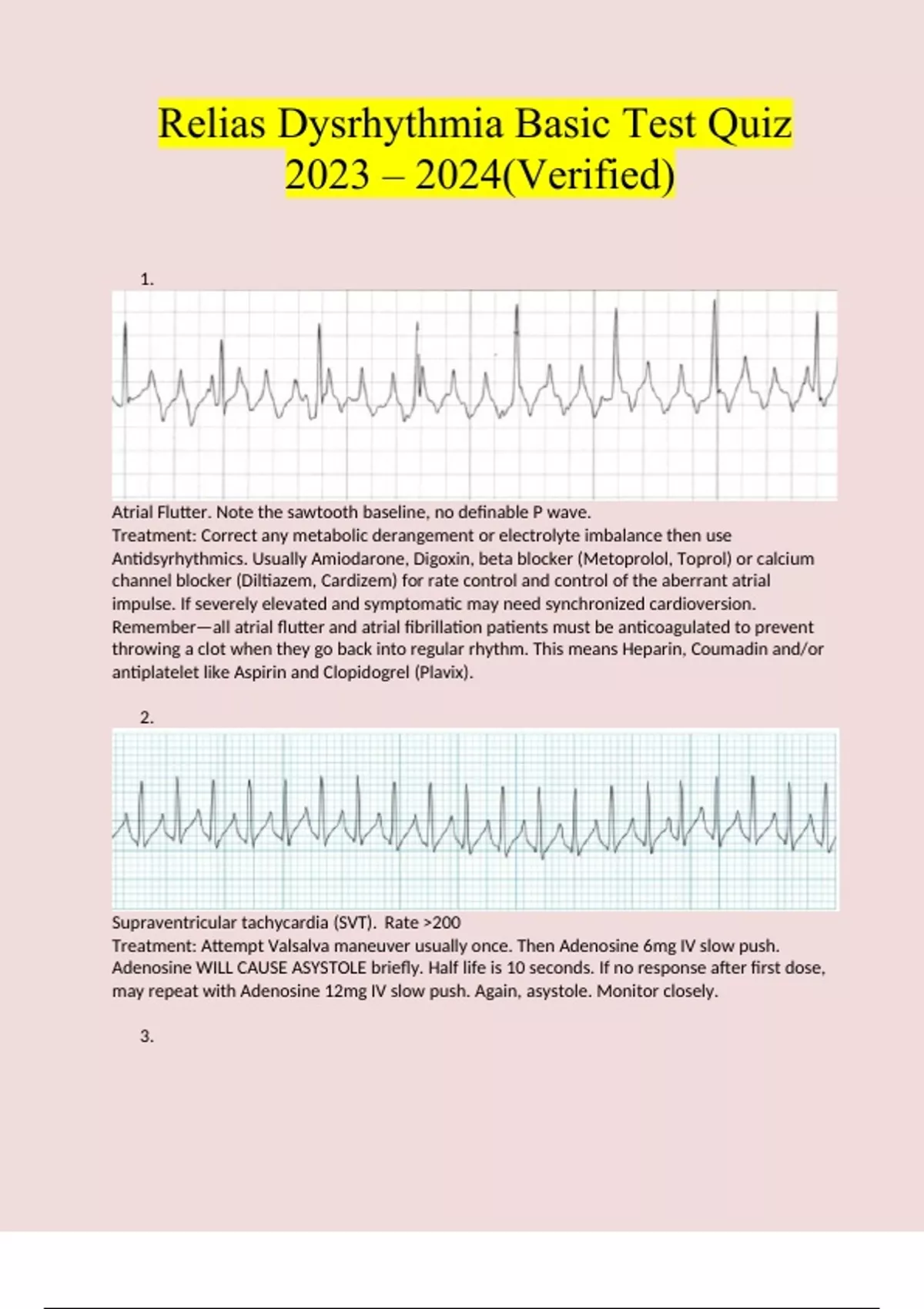 Relias Dysrhythmia Basic Test Quiz Questions And Answers (2023 / 2024 ...