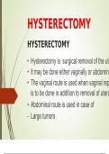 Hysterectomy