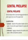 Genital Prolapse