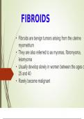 Fibroids