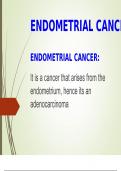 Endometrial Cancer