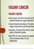 Vulvar Cancer