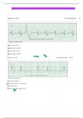 Latest Updated 2023 Relias Dysrhythmia – Basic A Test Actual Exam with Satisfied Questions and Verified Answers