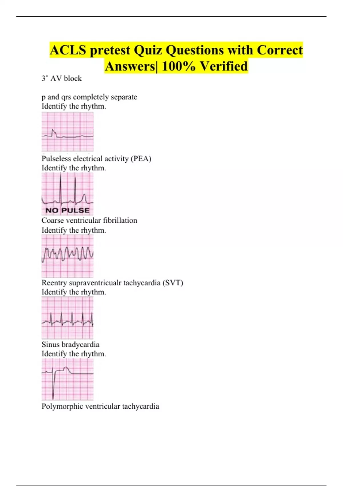 ACLS pretest Quiz Questions with Correct Answers 100 Verified ACLS