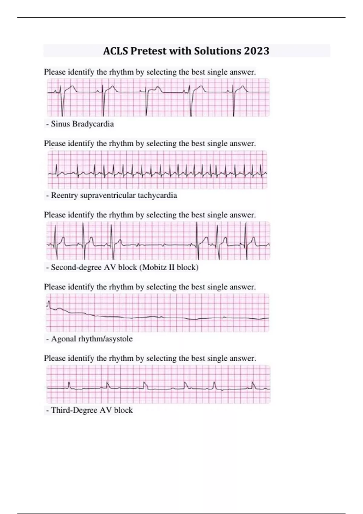 ACLS Pretest with Solutions 2023 Acls Stuvia US