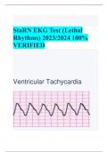 StaRN EKG Test (Lethal Rhythms) 2023/2024 100% VERIFIED 