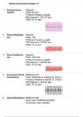 Relias Dysrhythmia Basic A