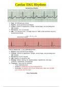 Cardiac EKG Rhythms 