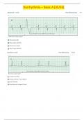 Relias Dysrhythmia Basic A Test and Answers 2023 [35 out of 35]