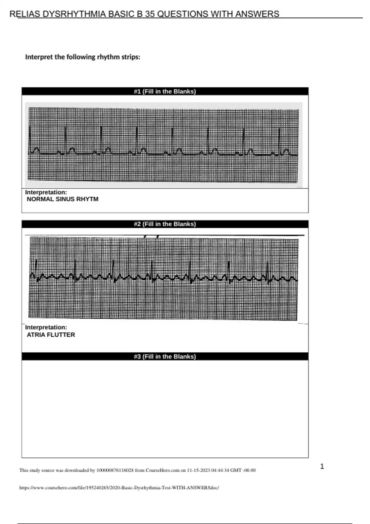 RELIAS DYSRHYTHMIA BASIC B 35 QUESTIONS WITH ANSWERS - Stuvia US