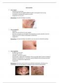 Screenen toets: acne soorten samenvatting- Huidtherapie jaar 2