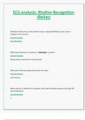 ECG Analysis: Rhythm Recognition (Relias)