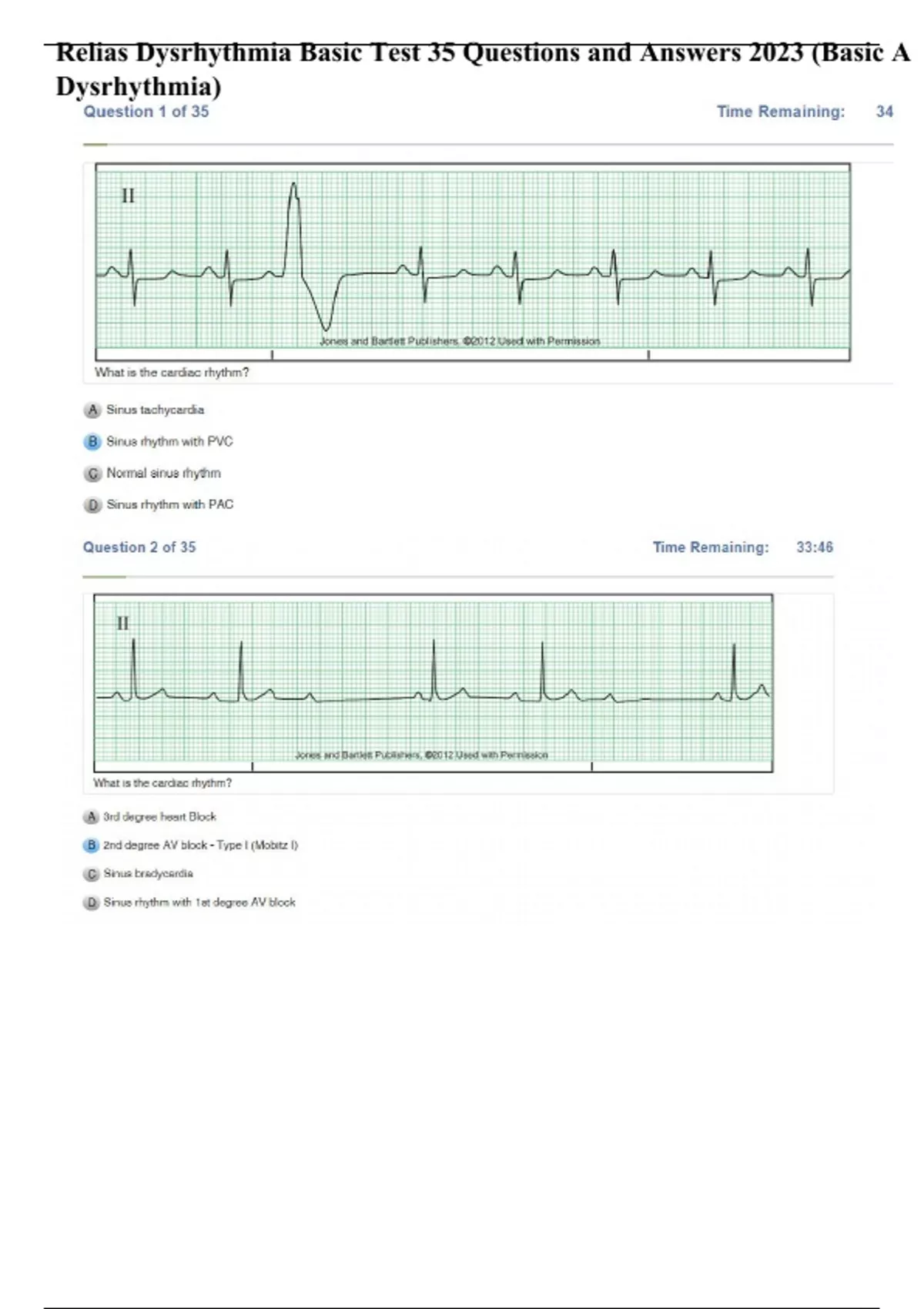 Relias Dysrhythmia Basic Test 35 Questions And Answers 2023 - Relias ...