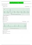 Relias Dysrhythmia Basic Test 35 Questions With 100% Correct  Answers| Updated 2024 (Basic A Dysrhythmia)A+ Graded Verified