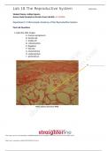 BIO 202L Lab 12 Worksheet- The Lymphatic System