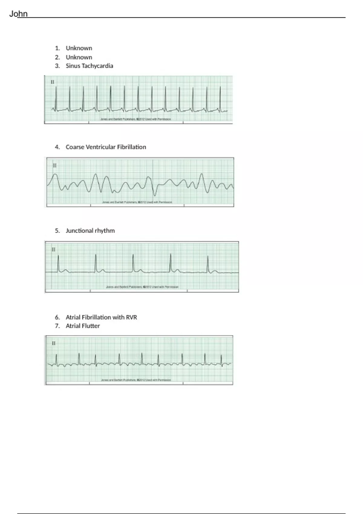 RELIAS DYSRHYTHMIA BASIC B 35 QUESTIONS WITH ANSWERS - RELIAS ...