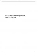 Basic EKG Dysrhythmia Identification