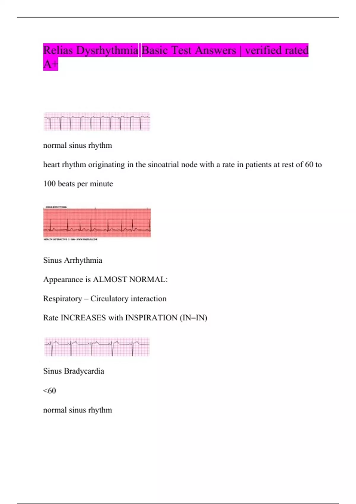 RELIAS DYSRHYTHMIA BASIC B 35 QUESTIONS WITH ANSWERS - Relias ...