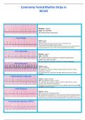 Commonly Tested Rhythm Strips in NCLEX 2024