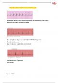 Relias Dysrhythmia Basic Test Answers Solution guide 2023.