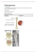 Osteoporose samenvatting