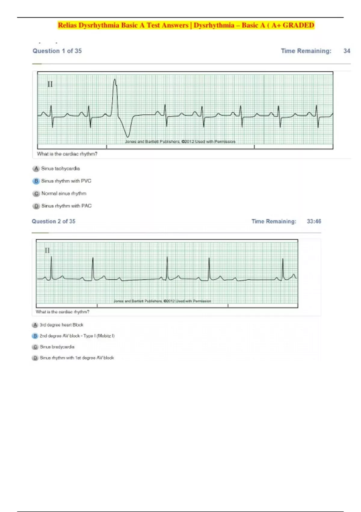 PACKAGE DEAL FOR RELIAS DYSRHYTHMIA BASIC TEST 2023 DYSRHTHMIA – BASIC ...