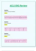 ACLS EKG Review_All Correct 100%