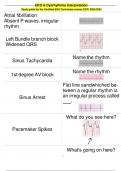 EKG & Dysrhythmia Interpretation Study guide for the Certified EKG Technician course (CET) 2023-2024