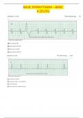 BASIC DYSRHYTHMIA